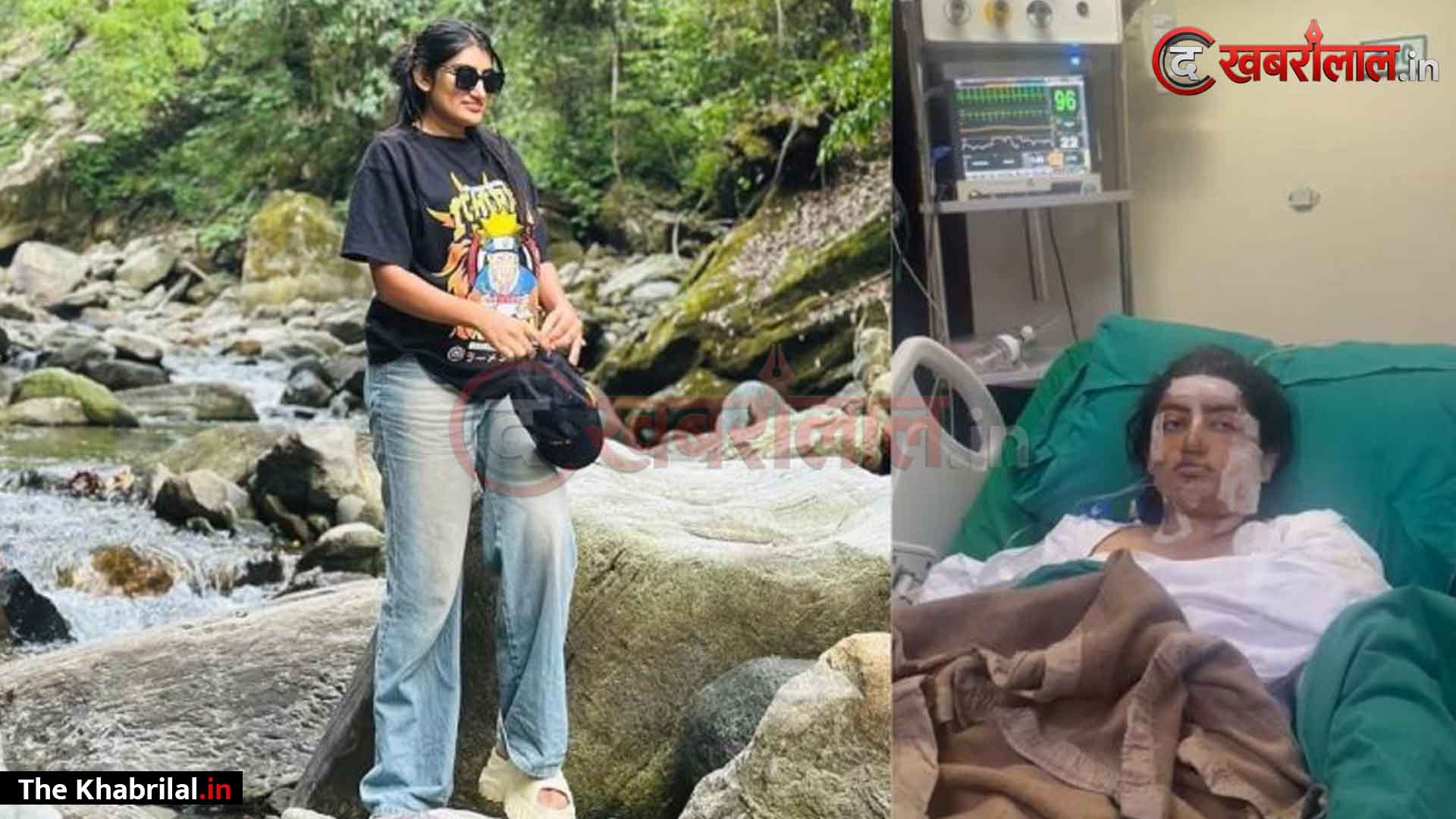 इंदौर गैस पाइपलाइन ब्लास्ट: अस्पताल के बेड से रो पड़ीं सोशल मीडिया इंफ्लुएंसर जिनी झाला; वीडियो जारी कर बोलीं— “लोग तमाशा देखते रहे, पानी के गड्ढे में कूदकर बचाई जान”