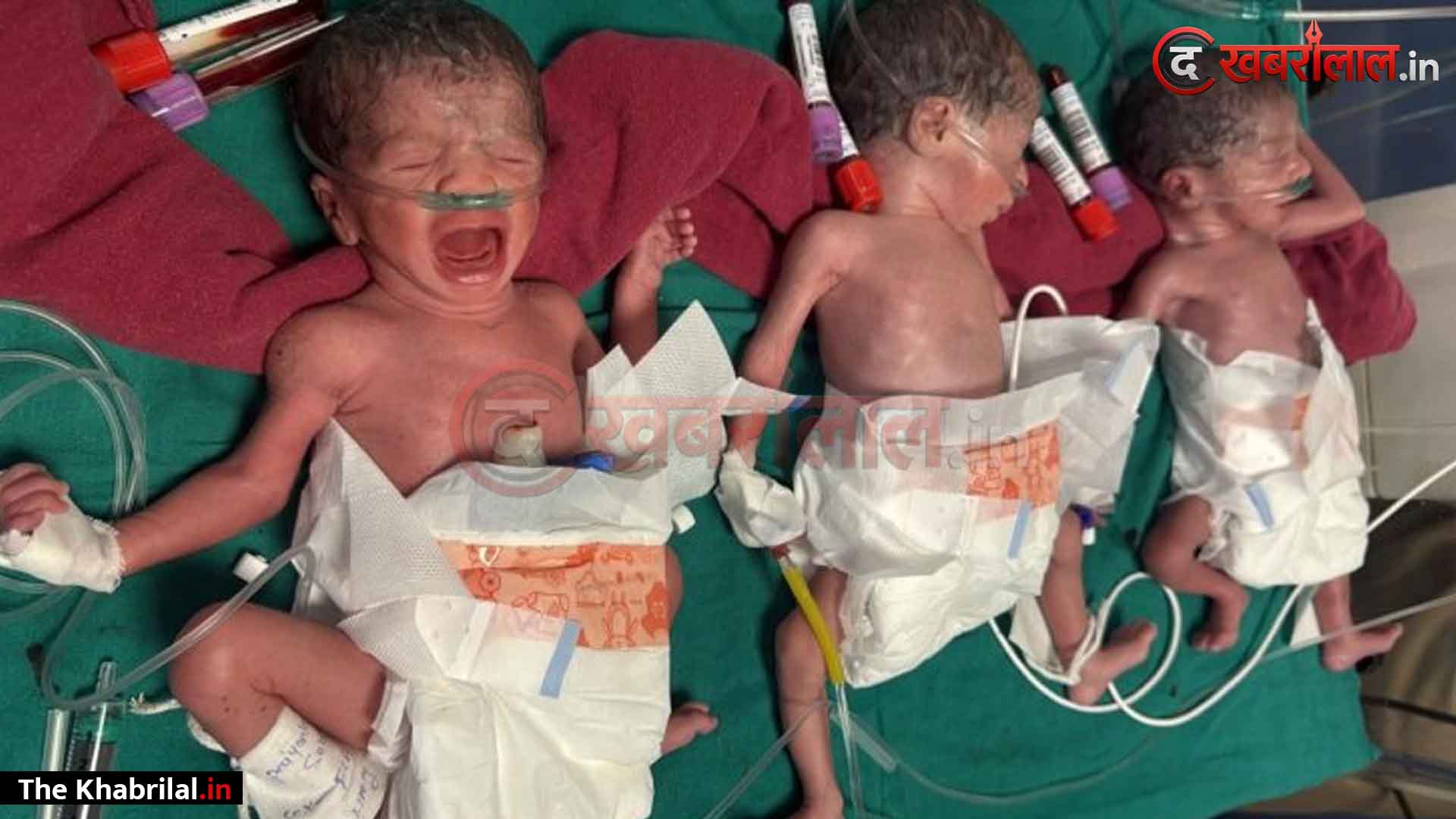 सतना जिला अस्पताल में दुर्लभ प्रसव! 7 माह की गर्भवती महिला ने नॉर्मल डिलीवरी से एक साथ तीन बेटियों को दिया जन्म; नवजात शिशु SNCU में भर्ती