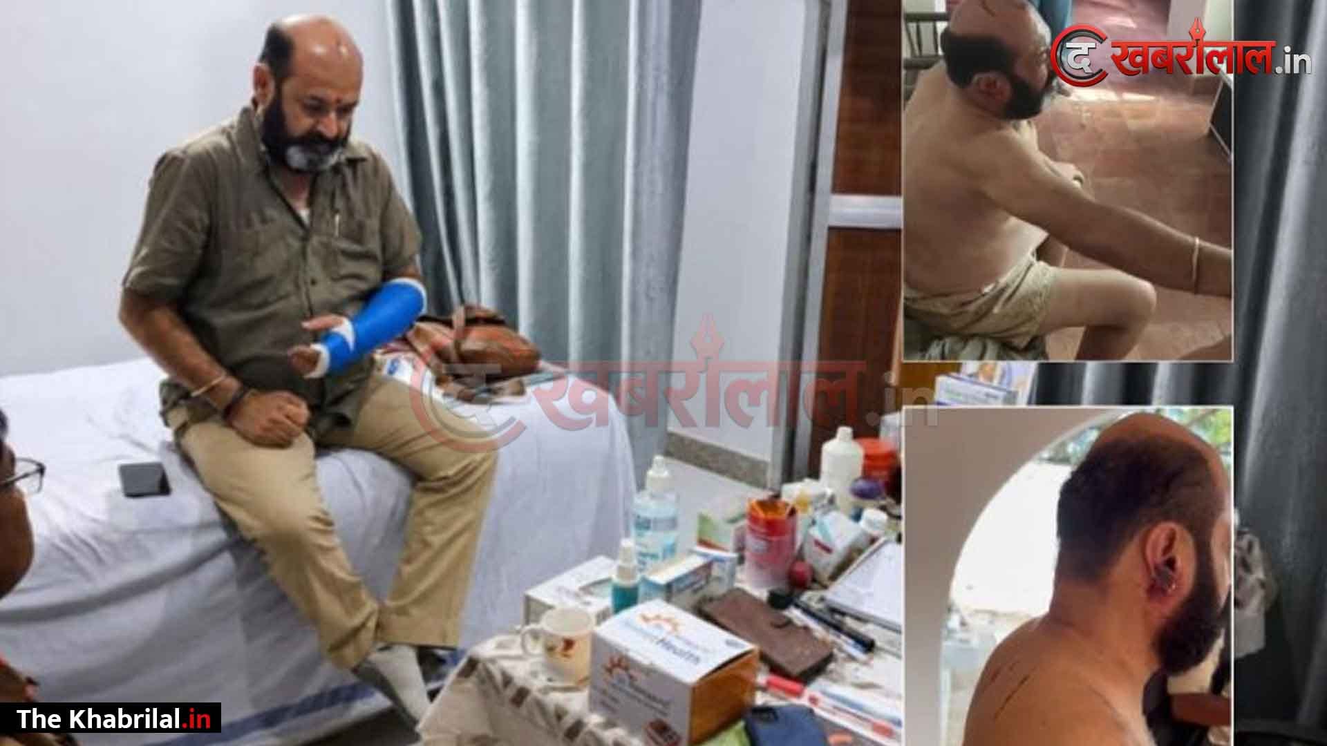 नागौद राजघराने गोलीकांड में बड़ा यू-टर्न: फायरिंग से पहले हुई थी बाबा राजा की जमकर पिटाई; फटे कपड़े और लहूलुहान हालत का वीडियो वायरल, साले समेत 3 पर FIR