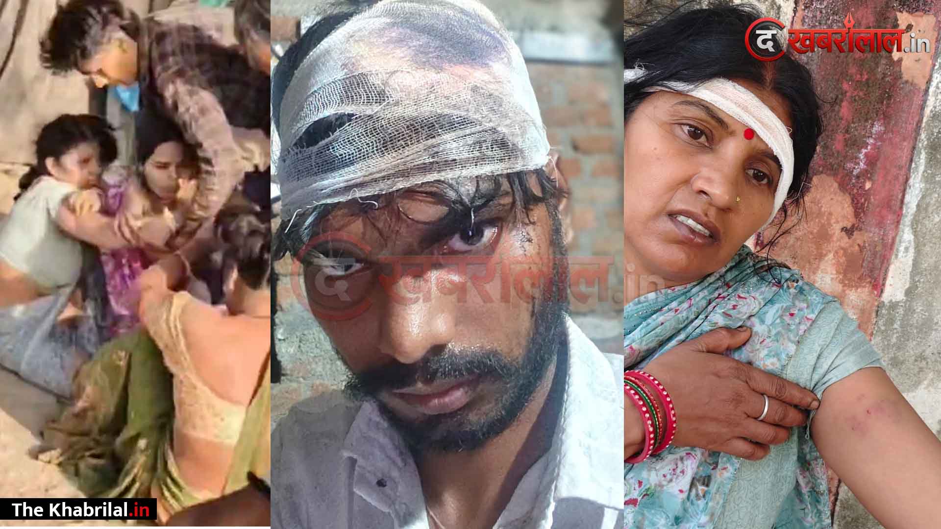 उचेहरा के बाबूपुर में बाँस विवाद पर खूनी संघर्ष:एक ही परिवार के दो गुटों में चले लाठी-डंडे 70 वर्षीय बुजुर्ग महिला,बहुओं और नाती को बेरहमी से पीटा