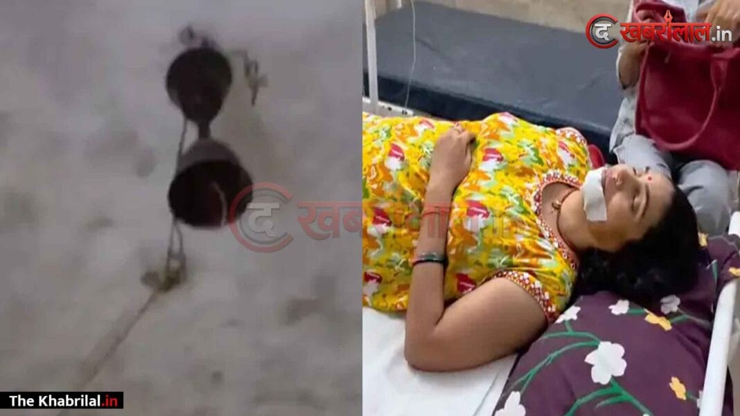 मैहर में घर पर आराम कर रही आशा कार्यकर्ता पर गिरा चलता सीलिंग फैन: चेहरे और गले में आई गंभीर चोटें; अमरपाटन सिविल अस्पताल में भर्ती मैहर में घर पर आराम कर रही आशा कार्यकर्ता पर गिरा चलता सीलिंग फैन: चेहरे और गले में आई गंभीर चोटें; अमरपाटन सिविल अस्पताल में भर्ती