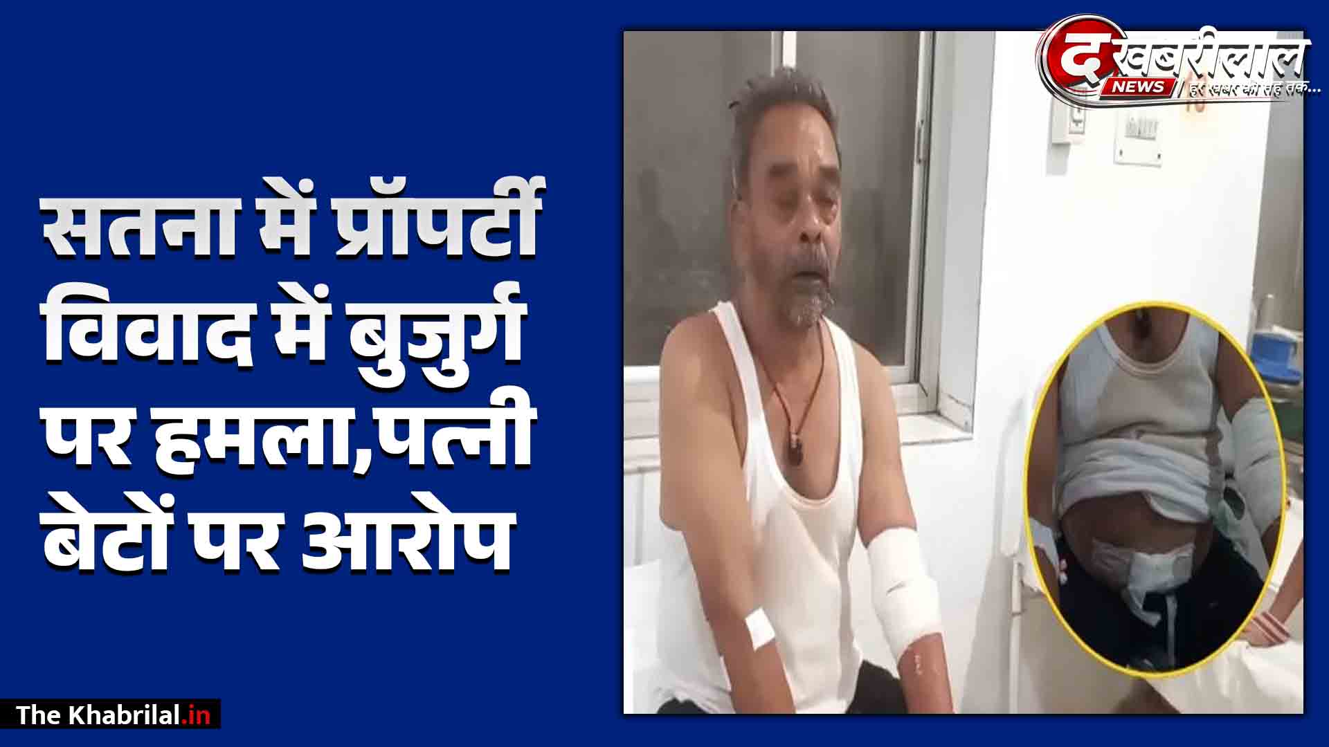 सतना: नागौद में पुश्तैनी मकान के विवाद में बुजुर्ग पर ग्राइंडर से हमला; पत्नी और बेटों पर हाथ काटने की कोशिश का आरोप, अस्पताल में भर्ती