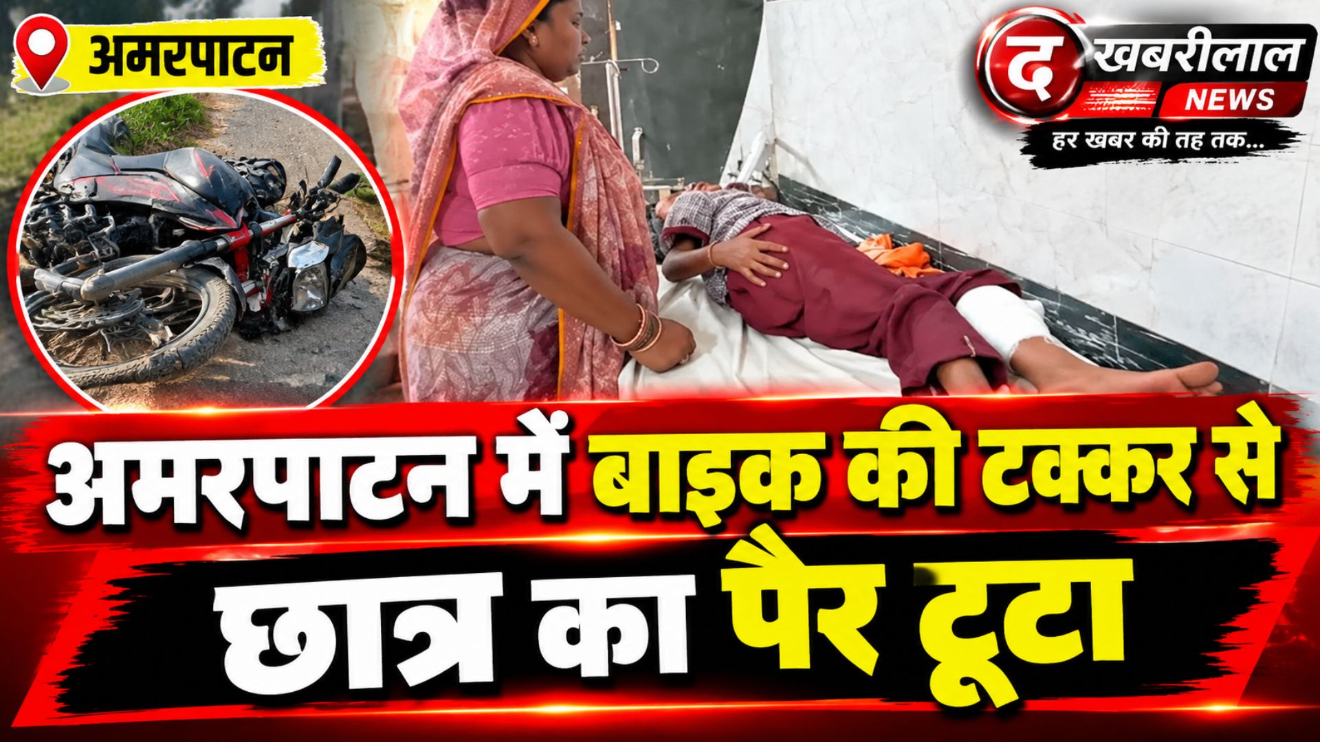 मैहर: स्कूल से लौट रहे 8 वर्षीय छात्र को बाइक ने मारी टक्कर; पैर फ्रैक्चर होने पर अमरपाटन से सतना रेफर, लालपुर-रामपुर बाघेलान रोड की घटना